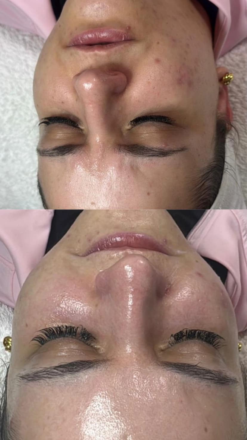 Ergebnis Permanent Make-up