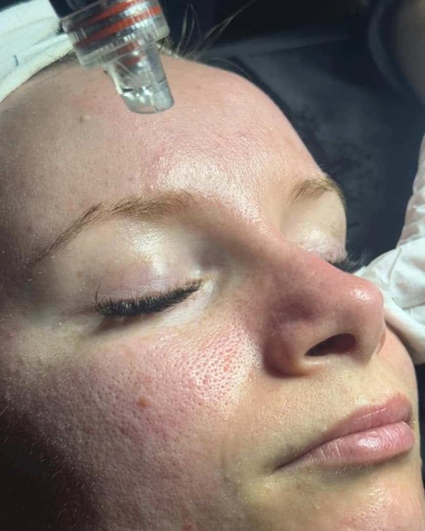 Ergebnis Permanent Make-up