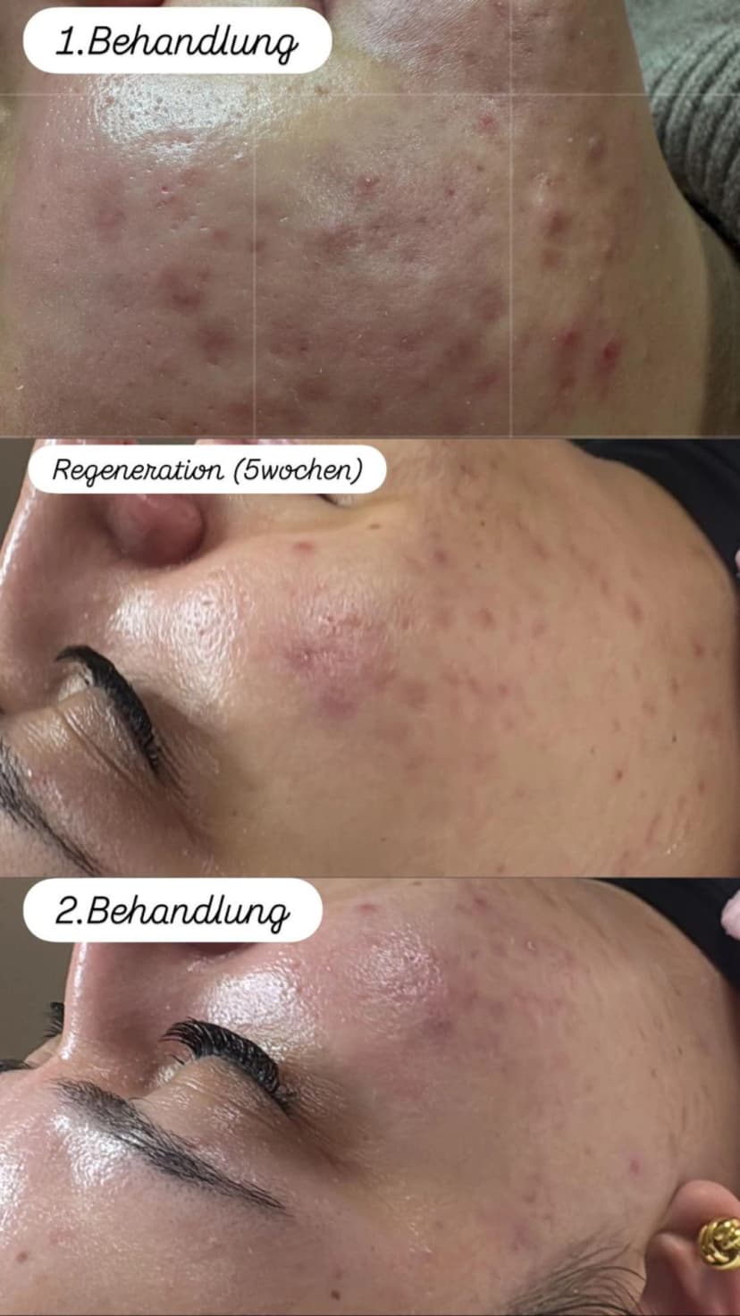 Ergebnis Bodyforming