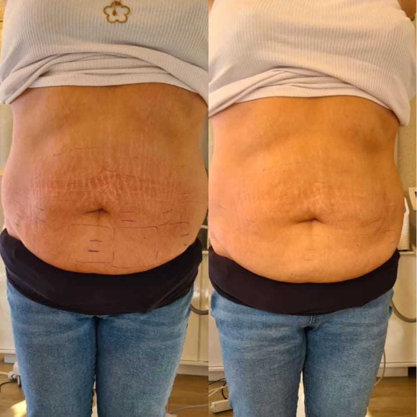 Ergebnis Bodyforming