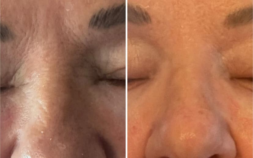 Ergebnis Bodyforming