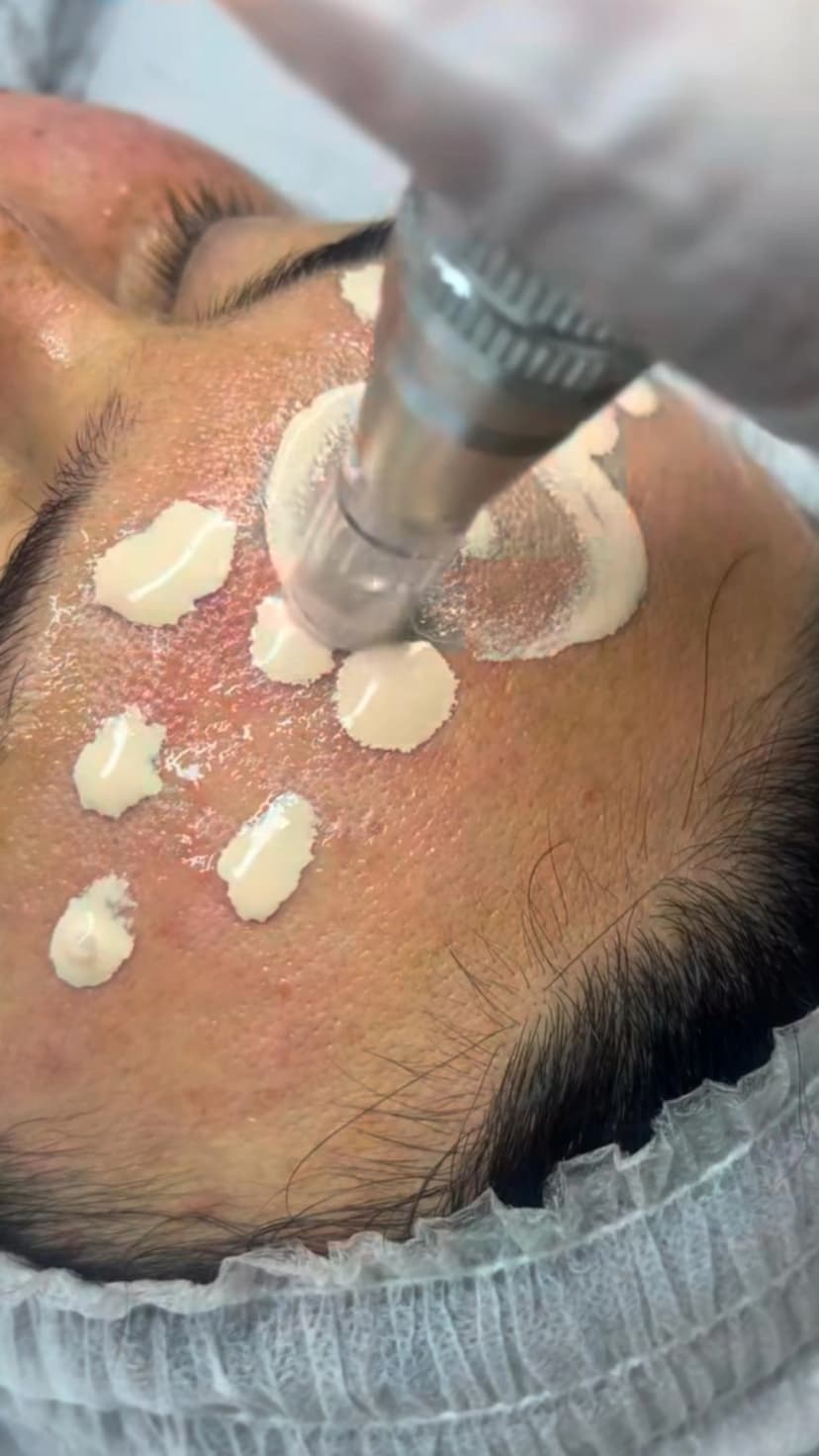 Ergebnis Bodyforming