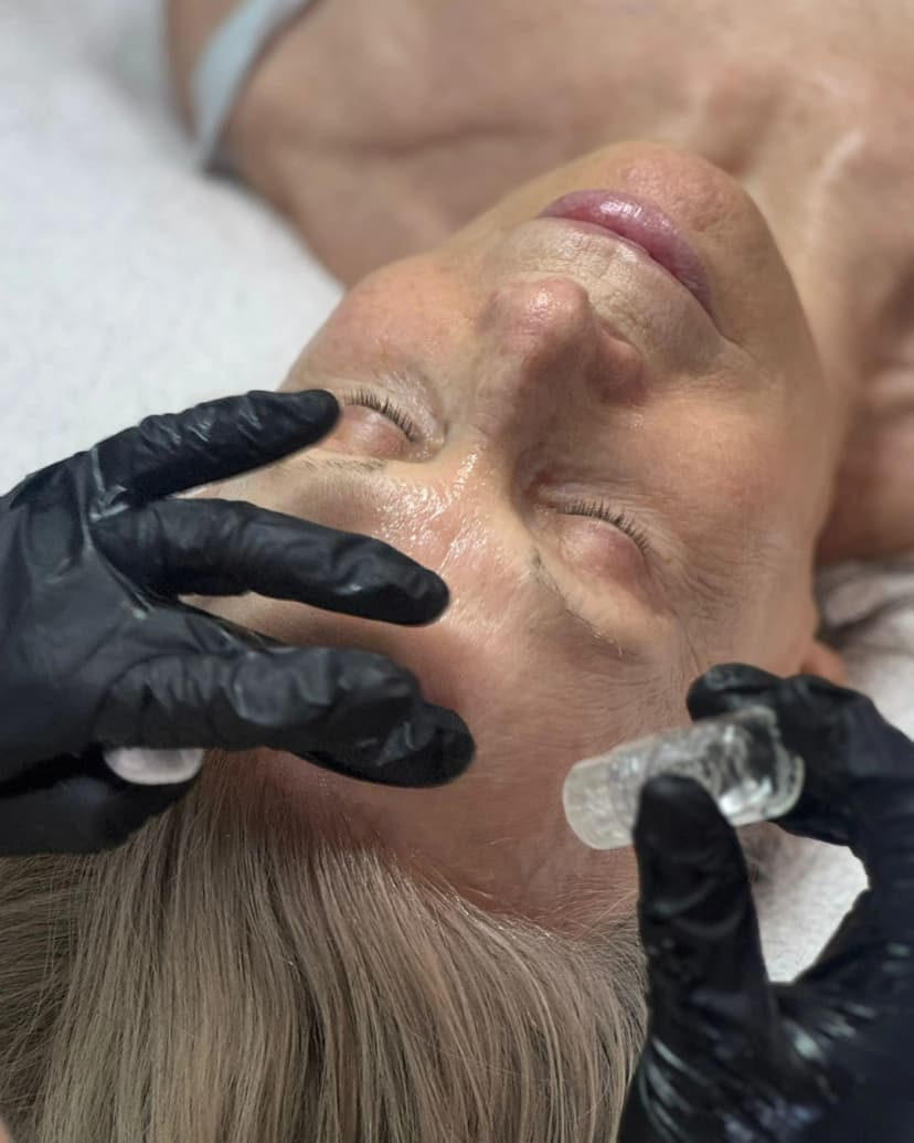 Ergebnis Microlifting