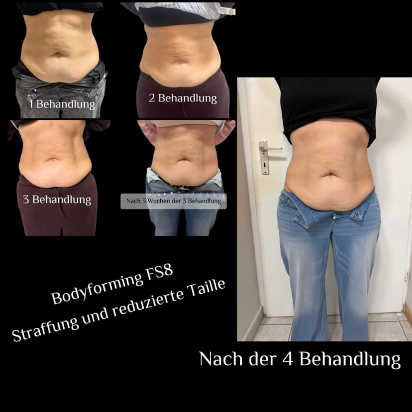 Ergebnis Bodyforming