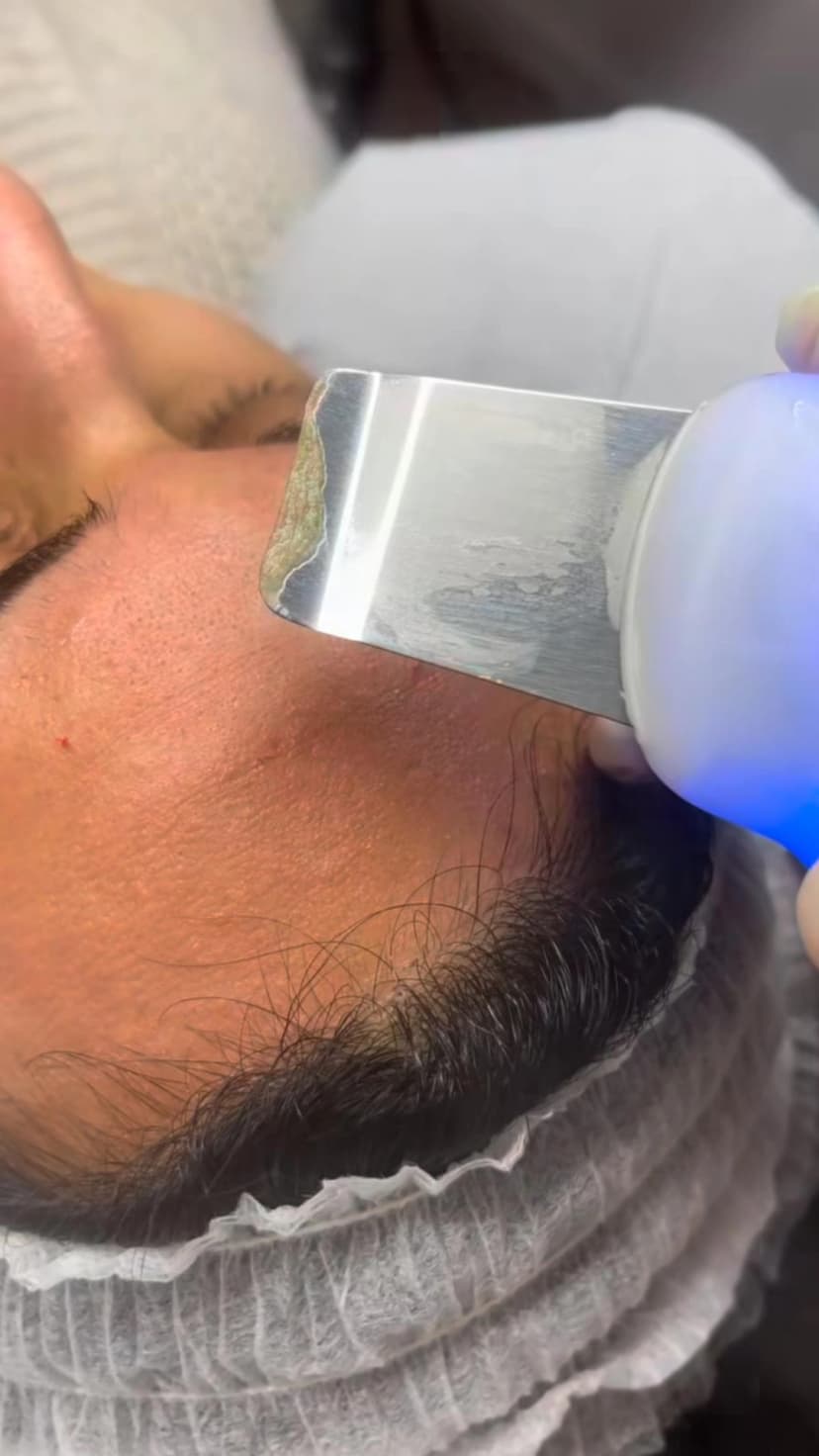 Ergebnis Gesichtsbehandlung