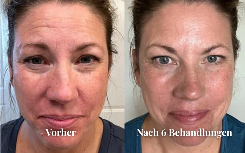 Ergebnis Permanent Make-up